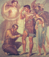 Япиг удаляет наконечник стрелы из ноги Энея. Фреска из Помпеи. I век до н.э.